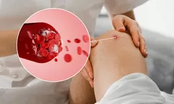 Fakta Golongan Darah O Tidak Mengalami Risiko Penggumpalan, Berikut Penjelasannya