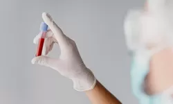 Mengenal Golongan Darah Bombay yang Mirip dengan Golongan Darah O Namun Berbeda