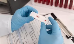 Mengenal Golongan Darah P, Salah Satu Golongan Darah Langka di Dunia