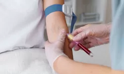 Golongan Darah Bisa Berubah, Benarkah? Simak Fakta dan Penjelasannya!