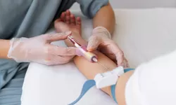 Bolehkah Melakukan Cek Darah Saat Puasa?