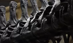 Kenali Apa Saja Pemicu Kanker Tulang dan Pencegahannya