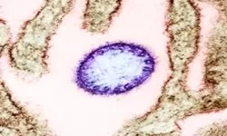 Virus Nipah: Gejala, Penyebab Hingga Penanganannya