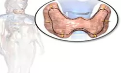 Mengenal Penyakit Tiroid yang Menggangu Metabolisme: Gejala Hingga Penanganannya