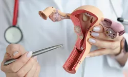 Benarkah Rahim Copot Bisa Terjadi? Ini Penjelasan Ilmiahnya yang Bikin Kamu Merinding!