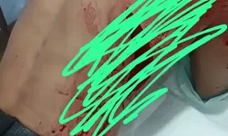 Tragis! Diduga Korban Begal Ditemukan Tewas di Amplas