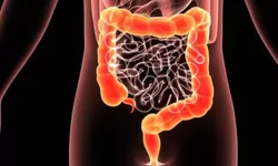 Macam Gangguan Pencernaan, Penyebab dan Cara Mengobatinya