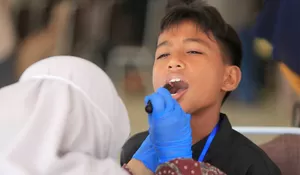 41 persen anak sekolah alami gigi berlubang