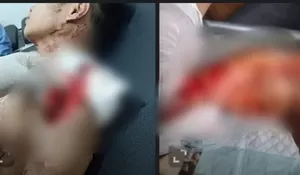 Puasa Berdarah di Kindang, Bapak dan Anak Baku Parang Hingga Sama-Sama Terluka