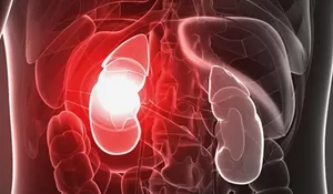 Pengacara Alvin Lim Meninggal Karena Gagal Ginjal, Kenali Kebiasaan Buruk yang Dapat Merusak Ginjal