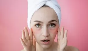 7 Langkah Praktis Hilangkan Mata Panda dengan Bahan Alami di Rumah, Cobain Deh!