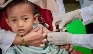 2.188 Suspek Campak di Jawa Tengah, Pemerintah Percepat Vaksinasi hingga ke Desa