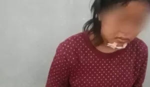 Niat Jemput Ayah, Remaja di Cikarang Diduga Jadi Target Begal, Sempat Ditendang hingga Alami Luka