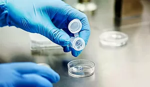 Heboh Pembekuan Sel Telur yang Dilakukan Luna Maya, Berapa Biaya Egg Freezing di Indonesia? Kaum Hawa Wajib Tahu