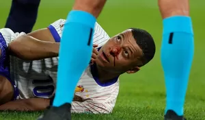 Harus Istirahat 15 Hari Akibat Patah Hidung, Kylian Mbappe Absen di Sisa Grup D Euro 2024