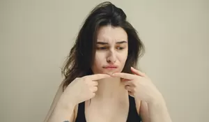 Skincare Saja Tak Cukup! Ini 3 Cara Mengatasi Jerawat Secara Menyeluruh