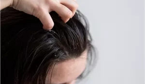 Punya Rambut Berminyak Berlebihan? Jangan Panik, Coba Lakukan 6 Tips Sakti Ini, Rambut Auto Terawat Hingga ke Akar!