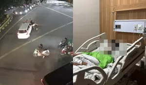 Kondisi Korban Kecelakaan Tabrak Lari di Lampu Merah Pulogadung: Dirawat Intens di RS Usai Jalani Operasi di Bahu dan Kepala