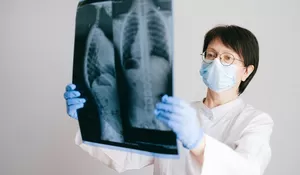 Lingkungan Nomor Satu! Ternyata Ini Penyebab dan Gejala Penyakit Paru-paru Basah