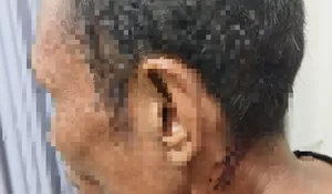 Nggak Tahu Diri! Usai Dipinjamkan Motor, Pria di Cileungsi Bogor Malah Pukuli si Pemilik Motor