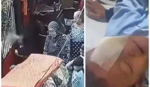 Mata Kiri Bocah 7 Tahun di Cipulir, Jakarta Selatan Digigit Anjing, Begini Kondisi Bocah Tersebut