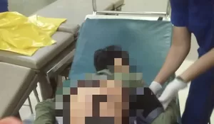 Ke Warung Beli Rokok Malah Diserang Sosok Misterius, Celurit Menancap di Punggung Remaja Asal Leuwiliang