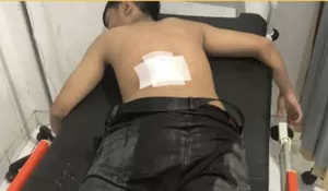 Perang Sarung Kebablasan, Remaja di Sukabumi Luka Parah Ditebas Golok