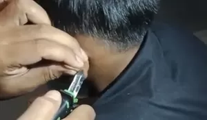 Lempar Kail Pancing Malah Nancap di Telinga, Damkar Turun Tangan