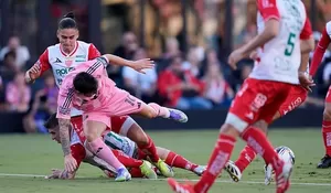 Tumbang Usai Dikeroyok! Messi Cedera Setelah Diredam 3 Pemain Necaxa