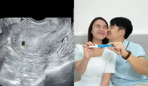 Amanda Manopo Umumkan Kehamilan Pertama, Unggah Foto Test Pack Bareng Kenny Austin