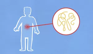 Mengenal Tanda-Tanda Usus Kotor Dan Cara Membersihkannya Secara Alami