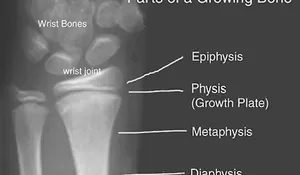 Tinggi Badan Manusia: Pengaruh Lempeng Epifisis Dan Proses Pertumbuhan Badan Seseorang