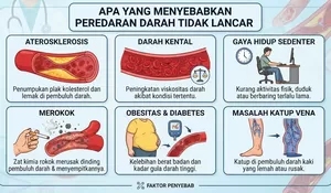 Apa yang Menyebabkan Peredaran Darah Tidak Lancar? Kenali Faktor Risikonya