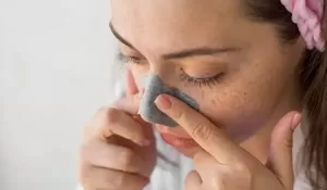 Bikin Percaya Diri Naik! 5 Tips Merawat Wajah agar Komedo Putih Berkurang