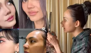 Dibilang Kehilangan Ciri Khas, Rina Nose Jawab Santai Kritik Operasi Plastik dengan Gaya Humoris