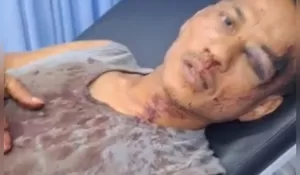 Ngeri ! 26 Korban, Ratusan OTK Diduga Secara Brutal Lakukan Penyerangan Terhadap Pekerja di Kebun Batang Kumu 2, Wilayah Hukum Polsek Tambusai Utara