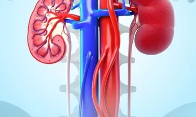 Waspada! Bahaya Konsumsi Gula Berlebihan, Memicu Gagal Ginjal Pada Usia Muda