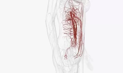 Makanan Ini Dapat Membersihkan Arteri Anda: Mencegah Penyumbatan Pembuluh Darah!