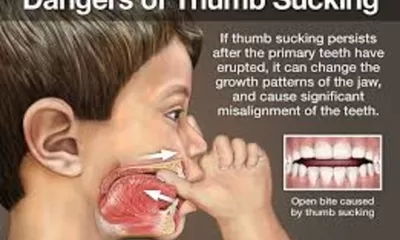 Cara Menghentikan Kebiasaan Isap Jari Pada Anak