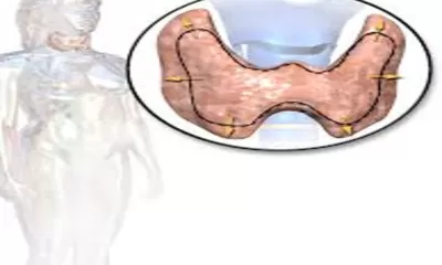Mengenal Penyakit Tiroid yang Menggangu Metabolisme: Gejala Hingga Penanganannya