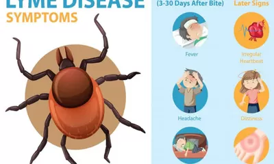 Cara Membedakan Penyakit Lyme dengan Flu Biasa atau Penyakit Autoimun