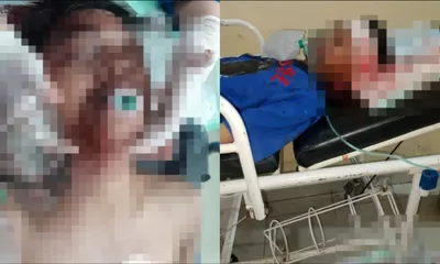 Kecelakaan Maut Jalan Soekarno Hatta Kota Palu, Dua Korban Kritis Belum Dijenguk Keluarga