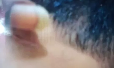 Tak Berperikemanusian" Anak Dibawah Umur Dianiaya Ibu Kandung Di Medan"