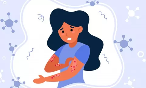 Apa yang Dirasakan oleh Penderita Autoimun? Kenali Gejalanya