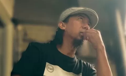 Yukie Pas Band alami kecelakaan di Arcamanik Bandung, terluka dengan 10 jahitan pada bagian kepala