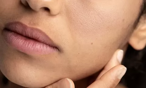 5 Tips Efektif untuk Mengangkat Sel Kulit Mati yang Menumpuk pada Wajah Menyebabkan kulit kusam