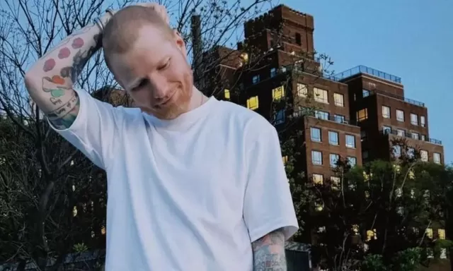 Ed Sheeran Ungkap Sempat Idap Herpes Zoster, Penampilannya Kini Bikin Pangling