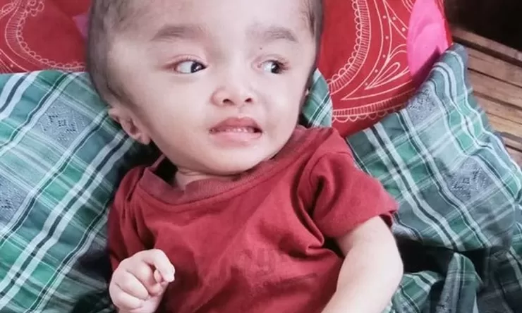 Tangis Maria Bocah 3Tahun di Manggarai Timur: Butuh Pertolongan, Kepala Terus Membesar, Orangtua Habis Harta Demi Pengobatan