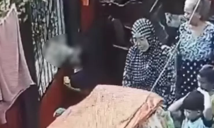 Digigit Anjing, Bocah 7 Tahun di Cipullir, Jakarta Selatan Alami Putus Syaraf Air Mata