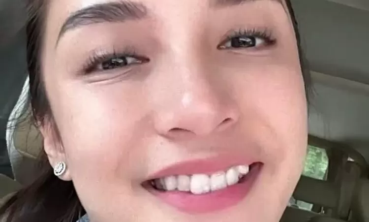Potret Chelsea Olivia Setelah Hilangkan Gigi Gingsulnya Netizen Merasa Sedih Lombok Insider
